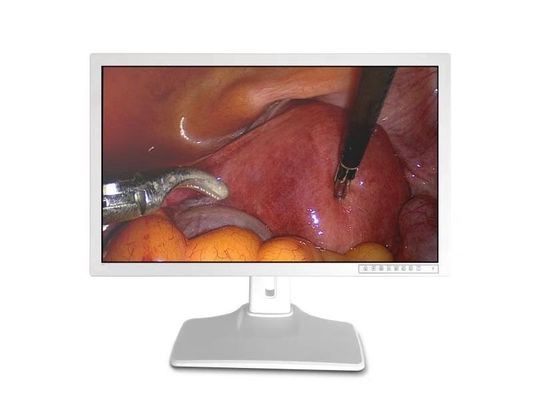 Gli accessori endoscopici medici visualizzano 32inch