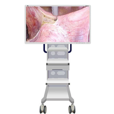Macchina fotografica medica del monitor dell'endoscopio con lo schermo 55inch