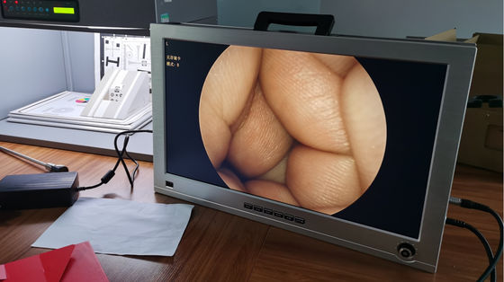 Il monitor a 22 pollici ha integrato il portatile pieno OTORINOLARINGOIATRICO dell'insieme del sistema della macchina fotografica dell'endoscopio di HD