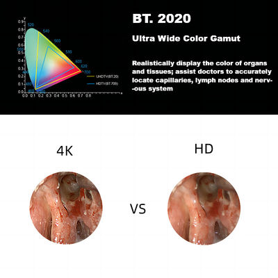 Nuovo 4K ultra HD sistema medico della macchina fotografica dell'endoscopio del dicembre 3840A per la laparoscopia
